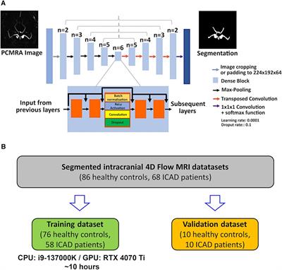 Automated intracranial vessel segmentation of 4D flow MRI data in patients with atherosclerotic stenosis using a convolutional neural network